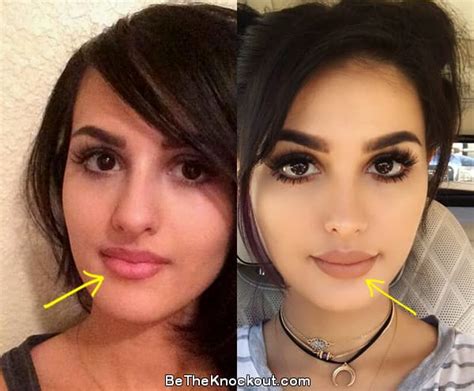 sssniperwolf before after|SSSniperwolf Plastic Surgery Comparison Photos